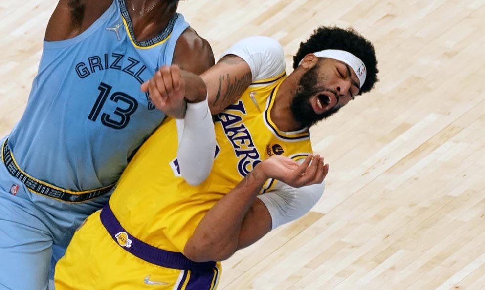 Plano Deportivo Anthony Davis es baja de Lakers por lesión